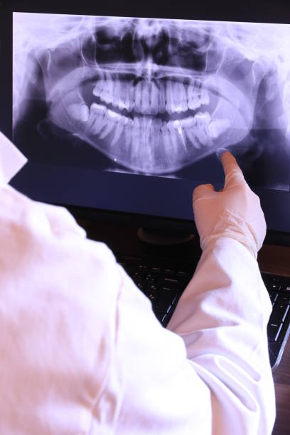 Best Emergency Treatment for Dental Infections or Abscesses in Sargent, TX