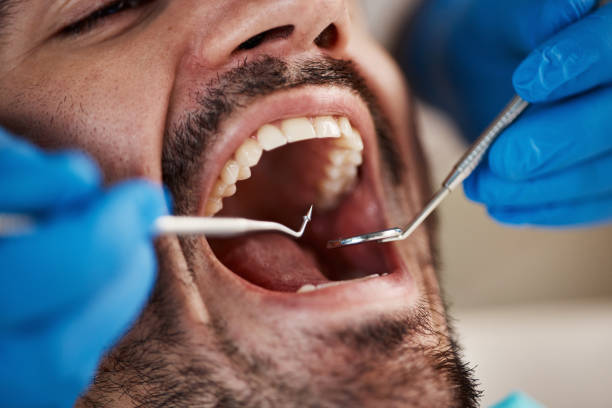 Best Urgent Care for Lost Fillings or Crowns in Sargent, TX